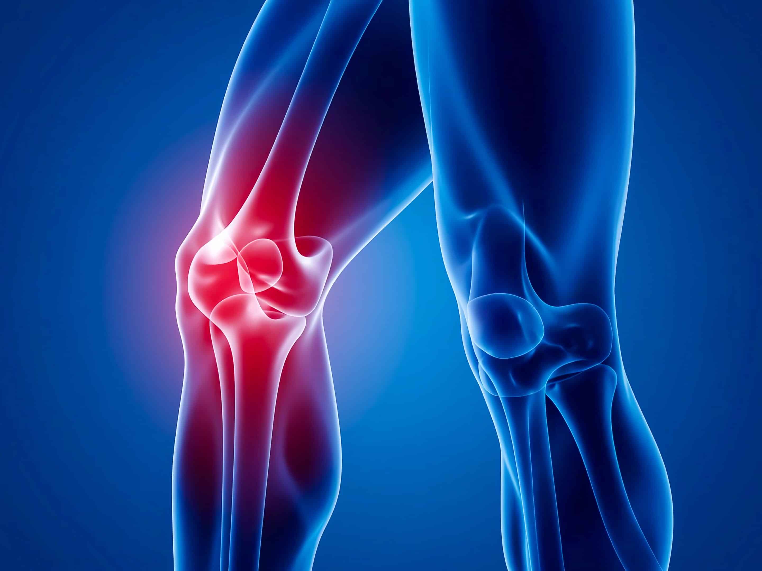 human leg in profile and glowing knee joint highlighted by red c