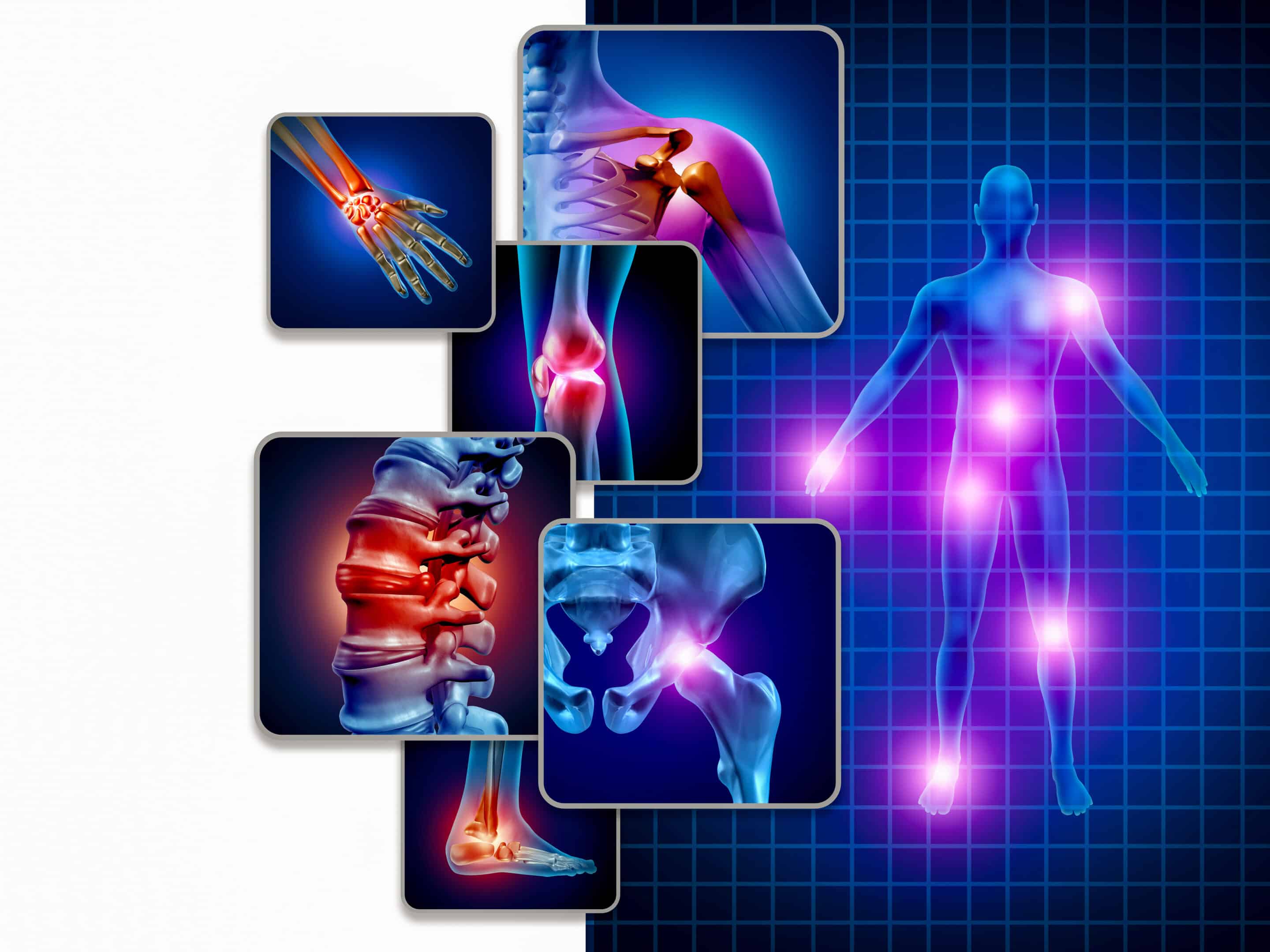 Joint body pain concept as skeleton and muscle anatomy of the body with a group of sore joints as a painful injury or arthritis illness symbol for health care and medical symptoms with 3D illustration elements.